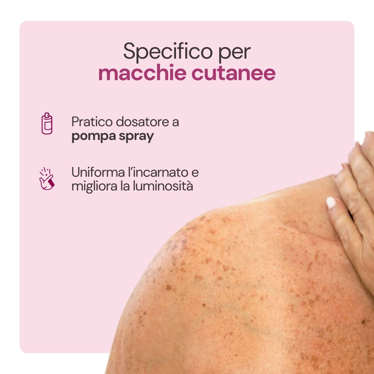 Iodase Cosmetics Spray per macchie cutanee