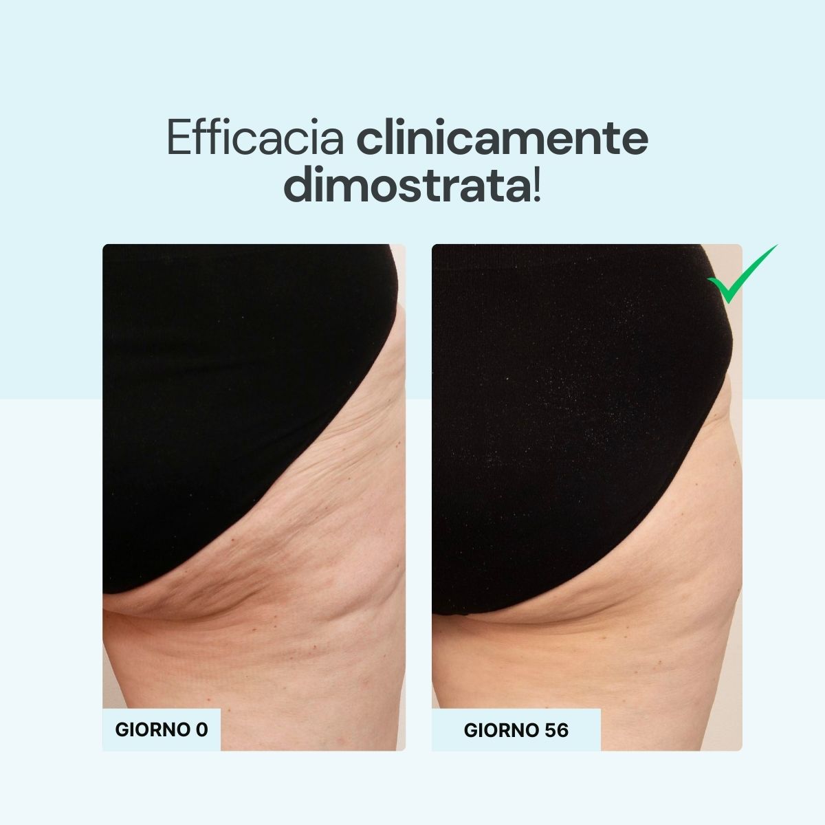 Iodase Cosmetics Crema cellulite effetto fresco