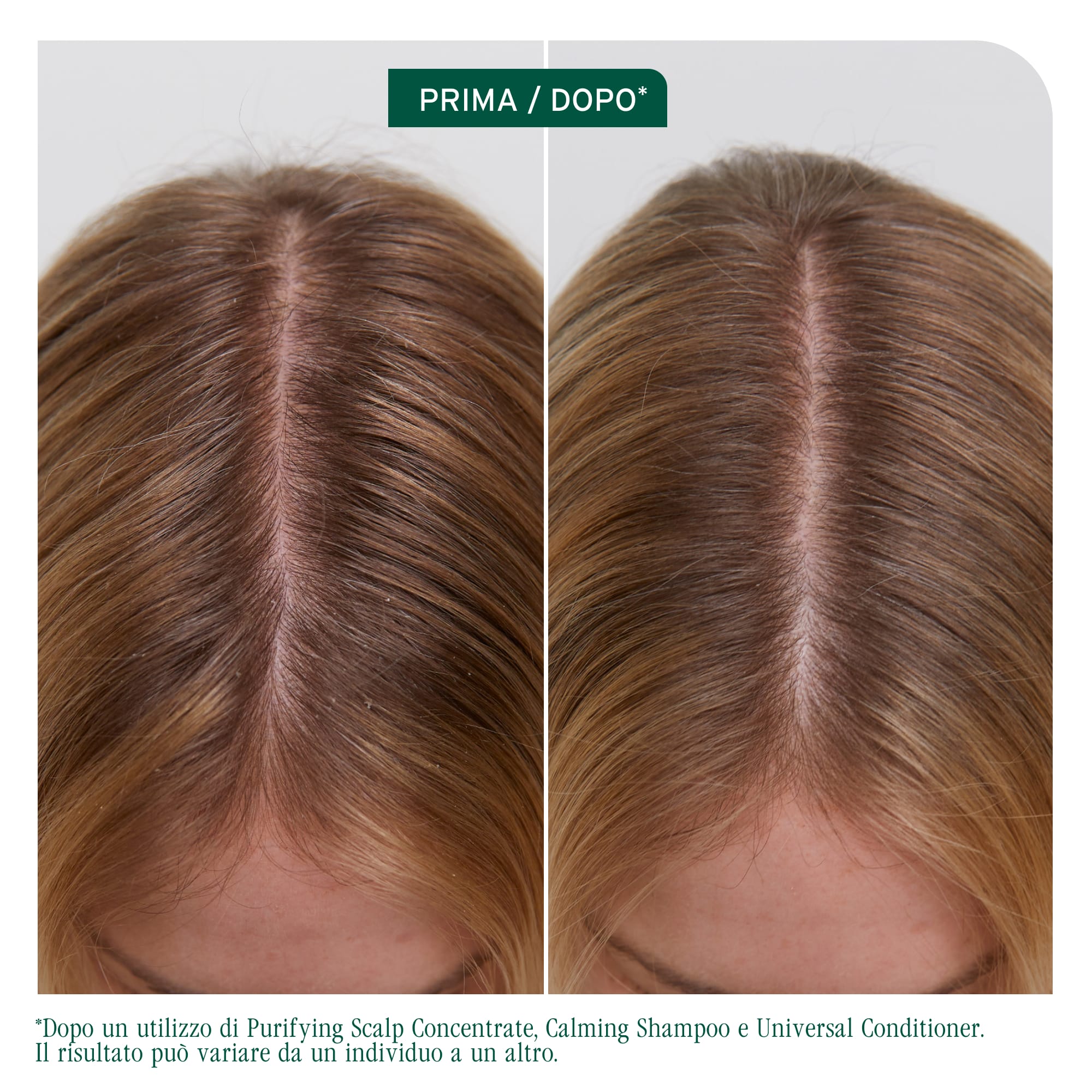 MATRIX BIOLAGE SCALP SYNC PURIFYING SCALP CONCENTRATE IDRATANTE